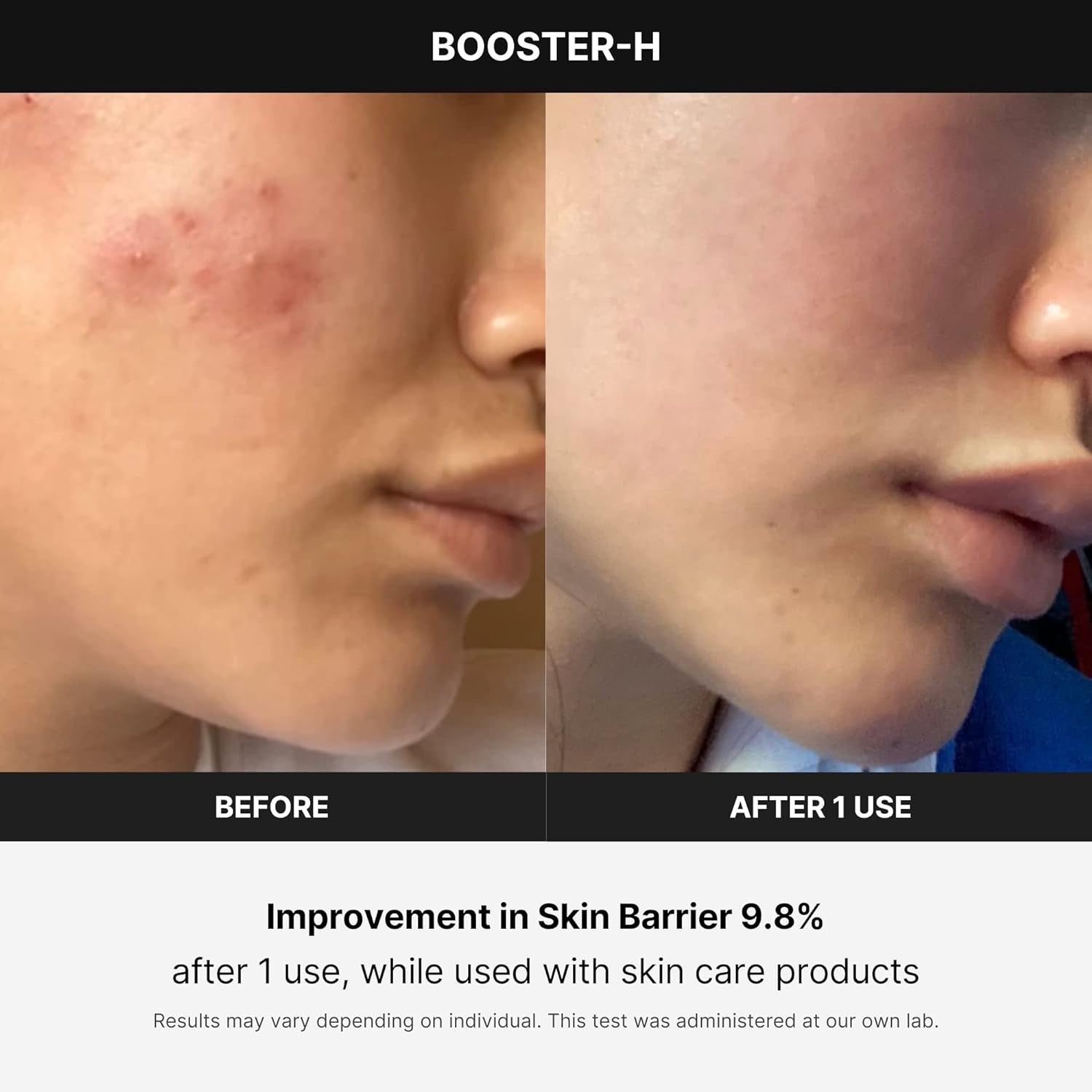 Booster H - Korean Skincare Tool - Facial Glow Booster for Maximizing and Boosting Skin Care Absorption - Needle Free