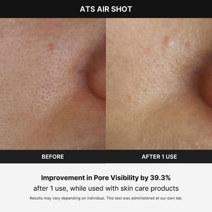 Age-R ATS Air Shot - Microneedling Skin Care Device for Pore Tightening, Enhanced Absorption, and Smoother Skin Texture - Exfoliation and Skin Rejuvenation - Korean Skincare