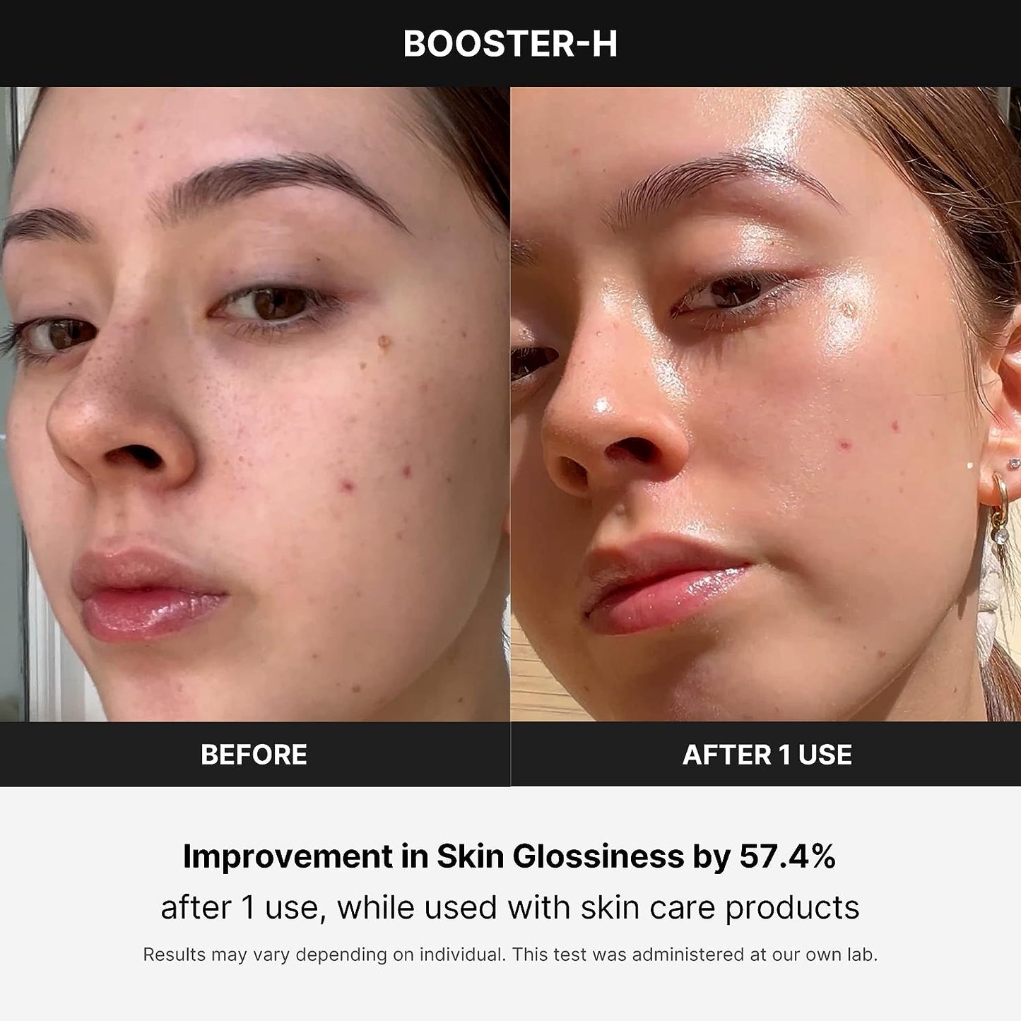 Booster H - Korean Skincare Tool - Facial Glow Booster for Maximizing and Boosting Skin Care Absorption - Needle Free