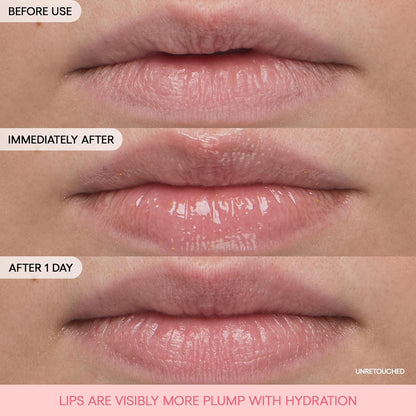 Bouncy & Firm Lip Treatment: Peony, Collagen Complex, Hydration, Visibly Firm & Plump, Ceramide Capsules, 5D Hyaluronic Acid