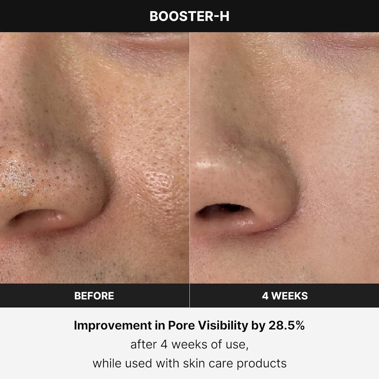 Booster H - Korean Skincare Tool - Facial Glow Booster for Maximizing and Boosting Skin Care Absorption - Needle Free