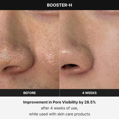 Booster H - Korean Skincare Tool - Facial Glow Booster for Maximizing and Boosting Skin Care Absorption - Needle Free