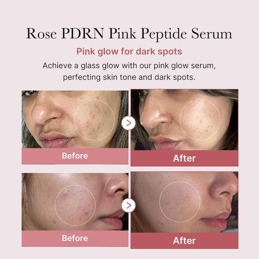 PDRN Pink Peptide Serum, Pink Glow Serum, Peptide, Niacinamide, Hydrating & Moisturizing & Firming, Uneven Skin Tone, Korean Skincare | 1.01 Fl.Oz. (1.01 Fl.Oz., Rose PDRN (Vegan))